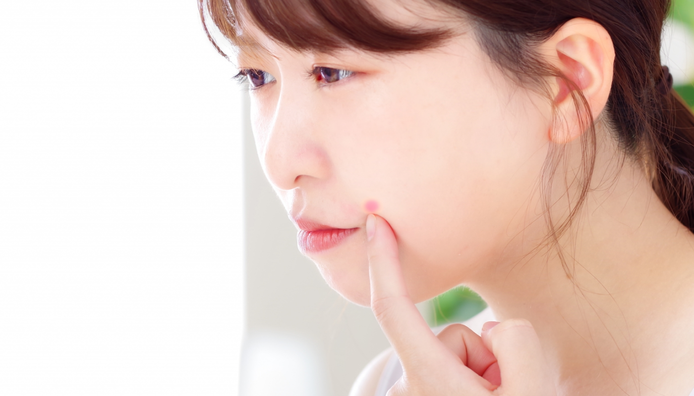 ➁摩擦で肌が傷つきやすい