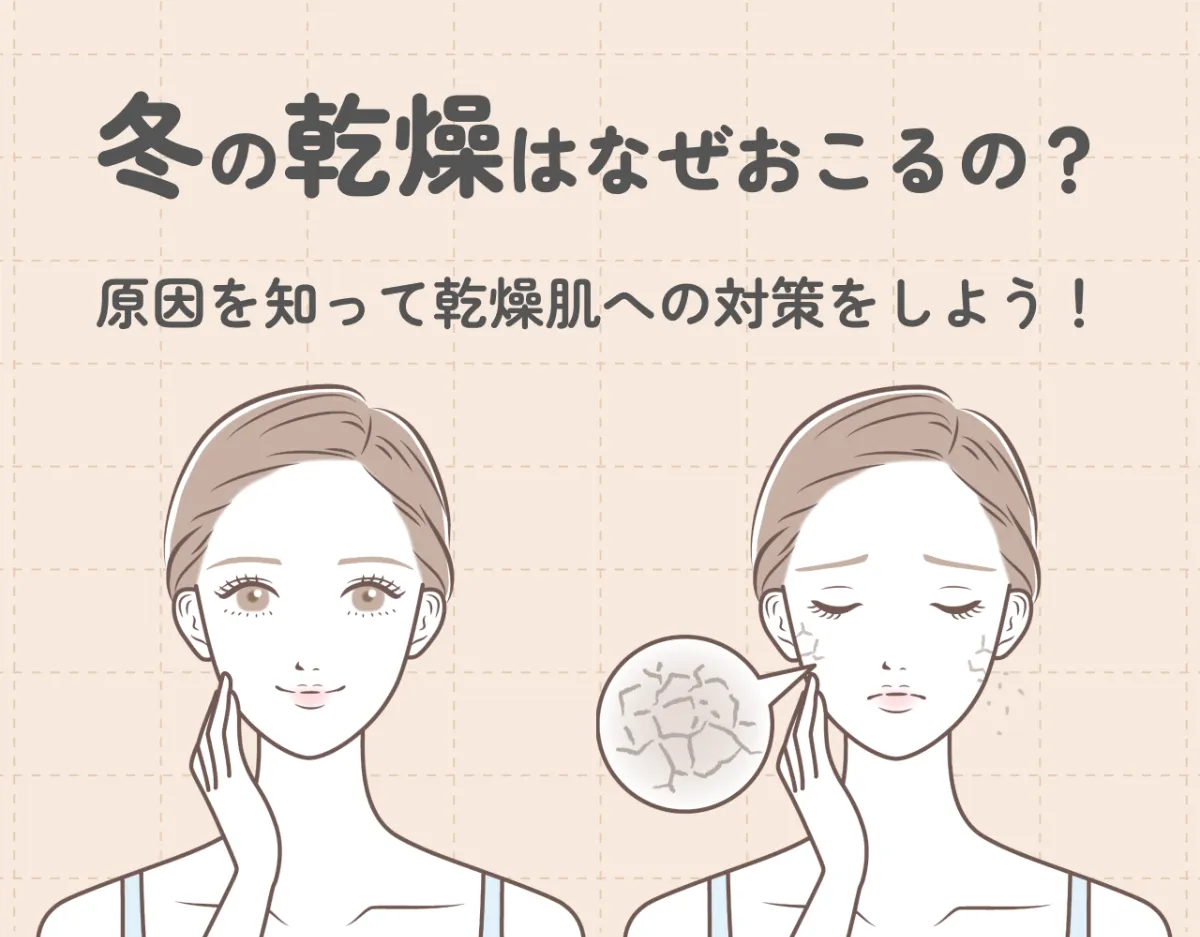 冬の乾燥はなぜおこるの？｜原因を知って乾燥肌への対策をしよう！