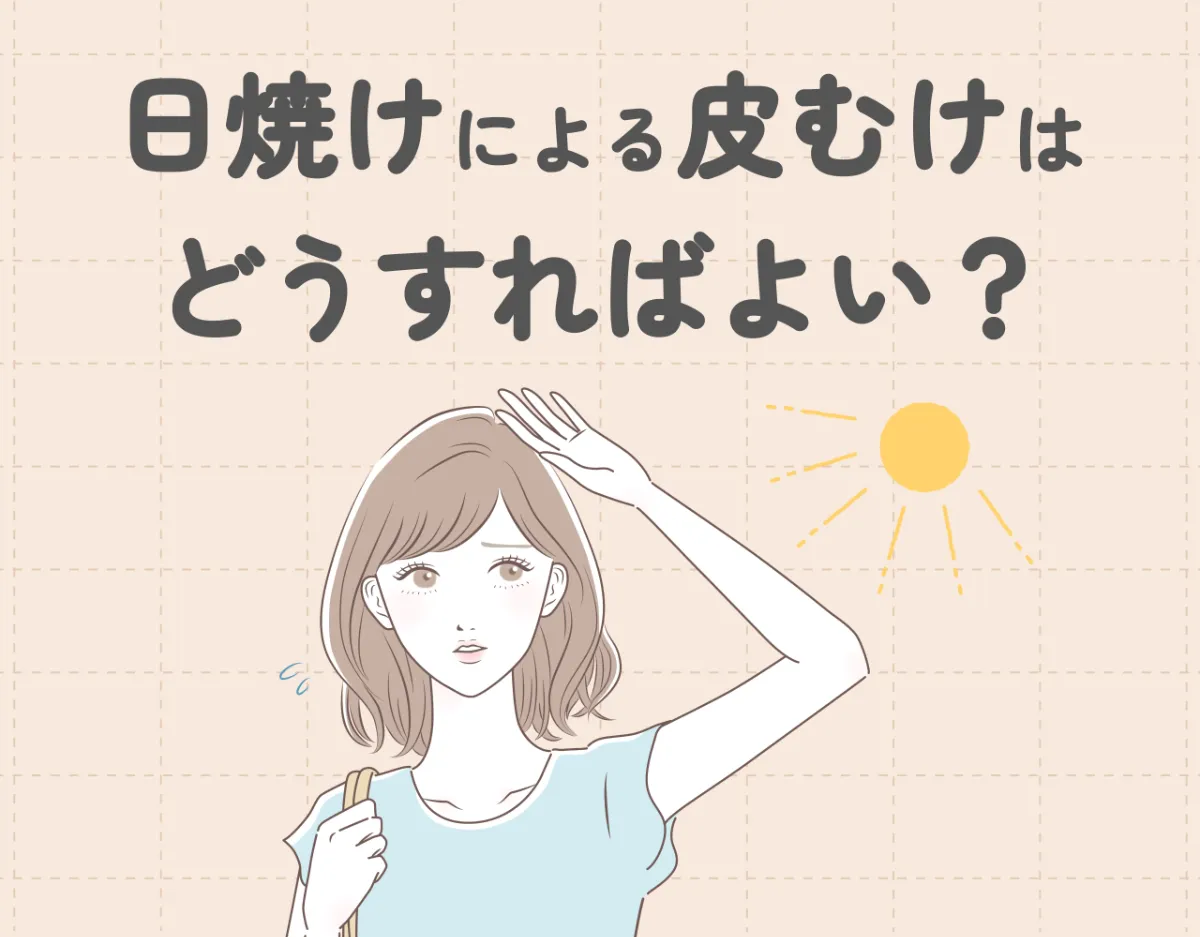 日焼けによる皮むけはどうすればよい？予防と対処アイテムもご紹介♡
