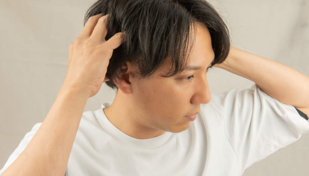 頭皮にツッパリ感を感じる