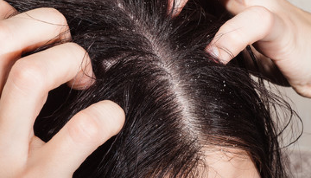 白残りしにくさを重視したい人向けのシャンプー3選