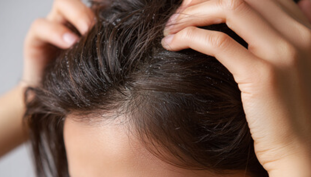 白残りしにくいかどうか