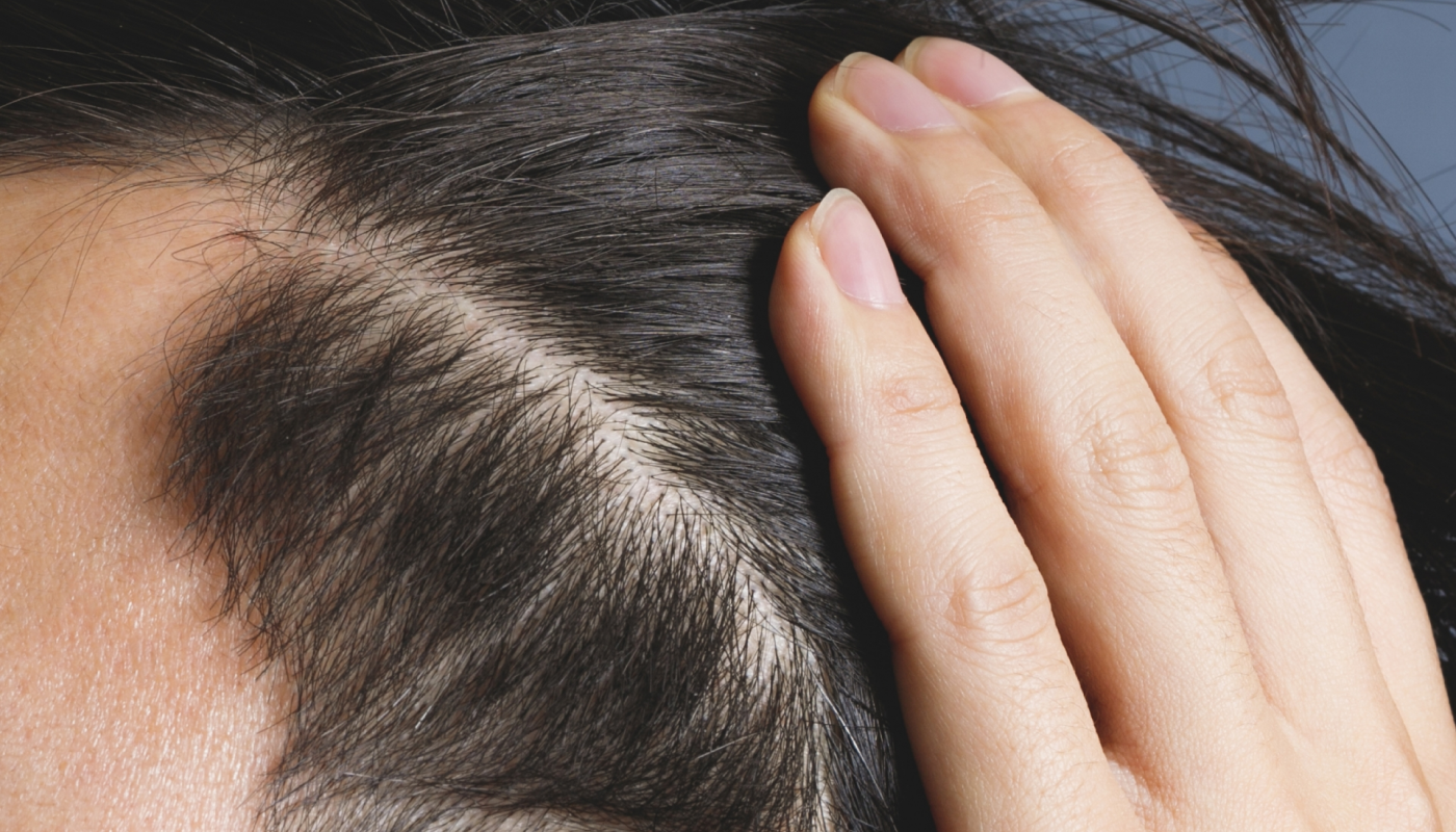 ステップ1：頭皮にヘアトニックを塗布する