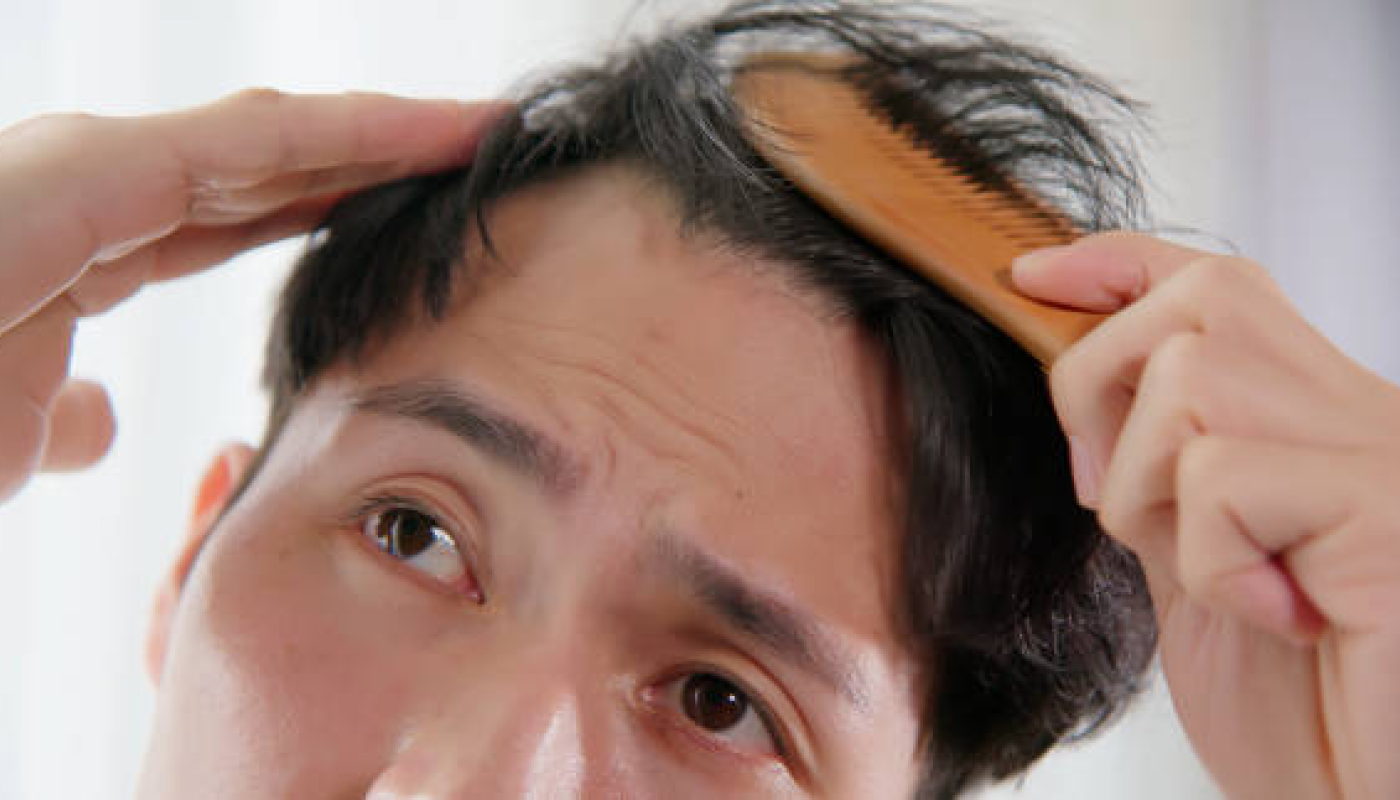 【ヘアオイルのデメリット】頭皮トラブルを引き起こすことも